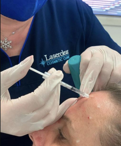 Dermal filler injections work to add volume to your face, enhancing your skin’s youthful appearance. Botox injections relax the muscles in the face to smooth out lines.

Visit us: https://laserclear.com.au/injectables/