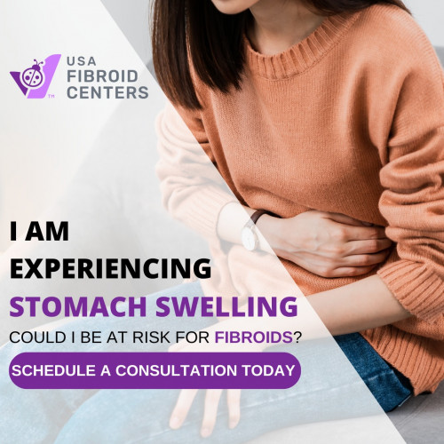 Are you experiencing stomach swelling? It could be a sign of fibroids! Get yourself a consultation today https://www.usafibroidcenters.com/schedule-online/