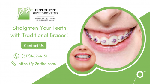 Make your smile glossy and even by using premium-quality orthodontic braces along with the guidance of experienced orthodontists to push it better than before. Schedule an appointment with Pritchett Orthodontics to figure out your suitable treatment methods and options right now! Get your wider laugh on!
