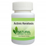 Actinic-Keratosis-Herbal-Treatment