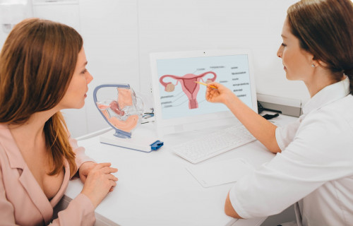 At USA Fibroid Centers, we specialize in performing Uterine Fibroid Embolization for intramural and subserosal fibroids.