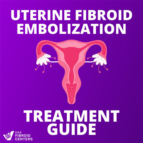 Here are some quick instructions on how to get ready for your uterine fibroids embolization procedure!