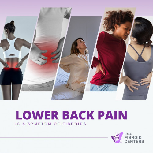 Lower back pain may be a result of your fibroids expanding and pushing against the kidney, preventing them from emptying. Your lower back may also hurt if a fibroid is pressing on the sciatic nerve