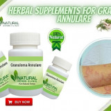 Herbal-Supplements-For-Granuloma-Annulare