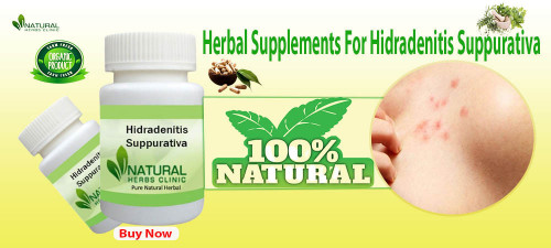 Herbal Supplements For Hidradenitis Suppurativa can help to treat the skin infection by decreasing its causes and symptoms. https://www.naturalherbsclinic.com/product/hidradenitis-suppurativa/