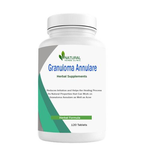 Herbal Supplements for Granuloma Annulare will help to decrease inflammation in the skin and expel toxins that may be causing the skin rash. https://www.naturalherbsclinic.com/product/granuloma-annulare/