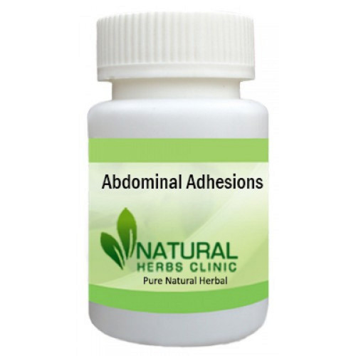 Herbal Treatment for Abdominal Adhesions read about the Symptoms and Causes. Abdominal Adhesions are bands of scar tissue between abdominal tissues and organs... https://www.naturalherbsclinic.com/product/abdominal-adhesions/