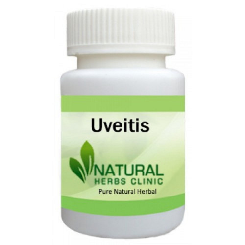 Herbal Treatment for Uveitis read the Symptoms and Causes. Uveitis is the inflammation of the middle layer of the eye called the uvea or uveal tract. The uvea provides most of the blood supply to the retina... https://www.naturalherbsclinic.com/product/uveitis/