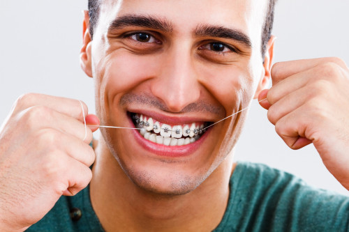 How-Waxed-Floss-Can-Help-with-Flossing.jpg