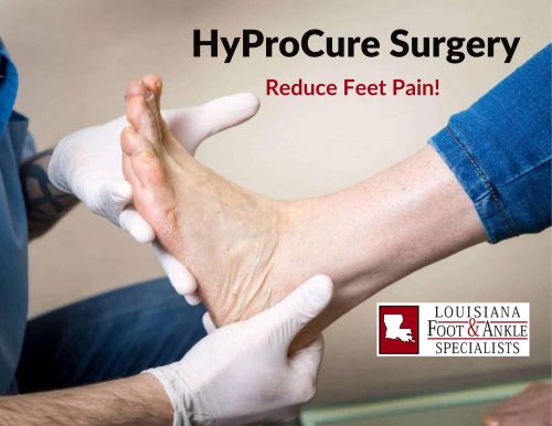 HyProCure treatment is an excellent option for treating patients of almost all ages with painful flat feet. Our experts can help to alleviate your chronic foot pain. Get in touch with us at (337) 474-2233.