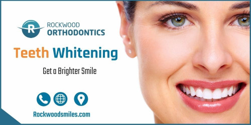 When your teeth are brighter, it can boost your self-confidence and leave you feeling fresh and rejuvenated. Book a teeth whitening today by email the office at info@rockwoodsmiles.com or using the online scheduling tool.