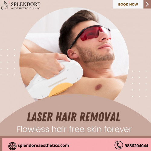 Laser-Hair-Removal-Surgery-in-HSR-Layout-Splendore-Aesthetic-Clinic.jpg