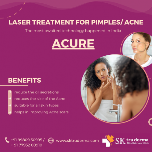 Laser Treatment for Acne, Dermatologist in Sarjapur Road