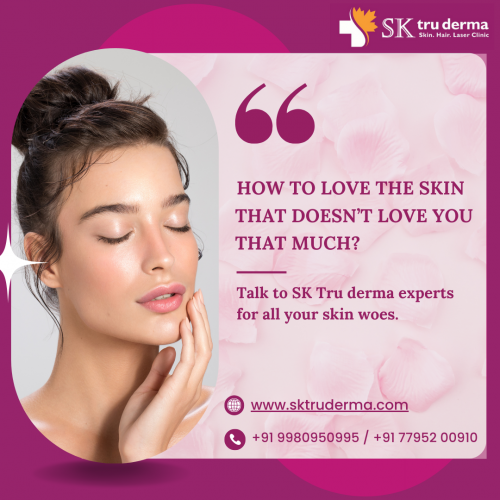 Love Your Skin, Best Dermatologist in Sarjapur Road