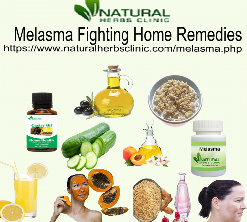 Lemon juice is the best Natural Remedies for Melasma cure. Its acidic nature and vitamin C component improve the discolorations and peel off the outer layer of the skin... https://melasmaherbalremedies.blogspot.com/2021/03/home-remedies-for-melasma.html