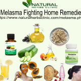 Melasma-Fighting-Remedies