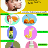 Natural-Remedies-for-Acne287846d9e43ad8e5