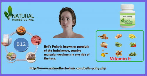 Bell's palsy is a situation in which a temporary weakness or paralysis of the muscles occurs in the face. It can happen when the nerve that manages your facial muscles turns in to inflamed, or compressed. Bell's palsy can be controlled with Natural Remedies for Bell's palsy without any side effects.... https://www.naturalherbsclinic.com/bells-palsy.php