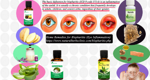 A wide range of oils can work excellently as Natural Remedies for Blepharitis. It brings quick relief and keeps most of the common blepharitis symptoms under control... https://blepharitisnaturaltreatment.blogspot.com/2021/02/Natural-Remedies-for-Blepharitis.html