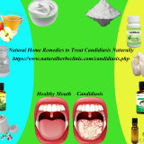 Natural-Remedies-for-Candidiasis