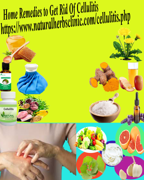 Ginkgo Biloba is a very nice herbal ingredient that can be used in Natural Remedies for Cellulitis to obtain a positive result to get rid of the disease... https://naturalherbcure.livejournal.com/2792.html