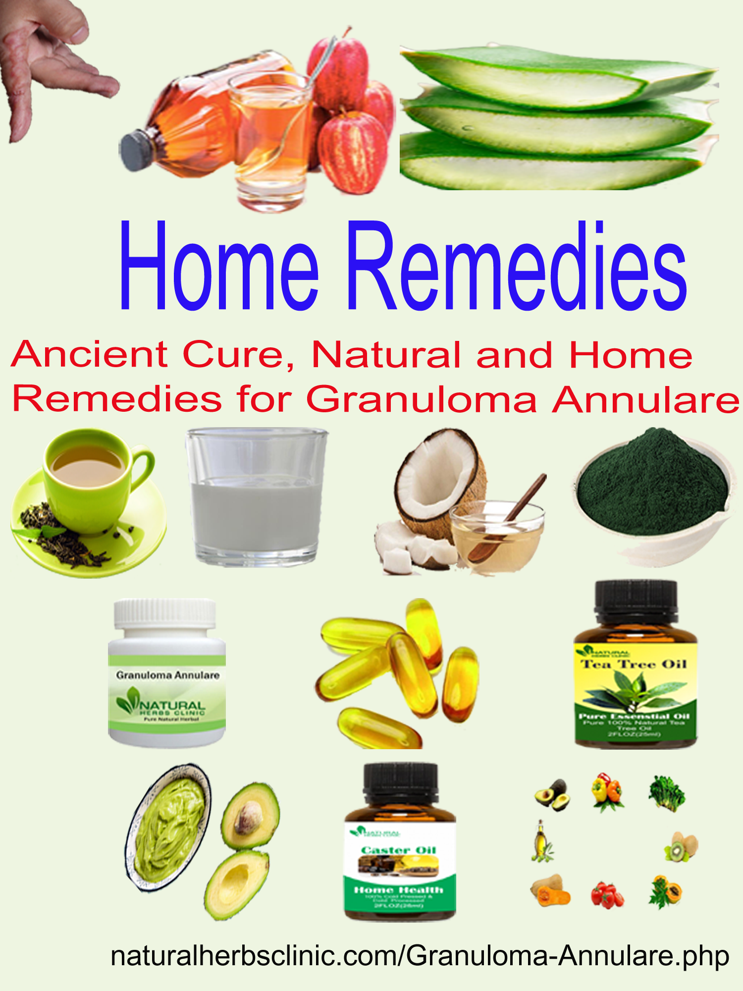 Naturals remedies