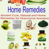 Natural-Remedies-for-Granuloma-Annulare