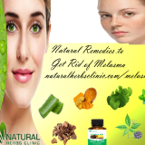 Natural-Remedies-for-Melasma