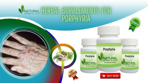 Porphyria-Herbal-Supplements-Use-the-Best-Treatment-Option.jpg