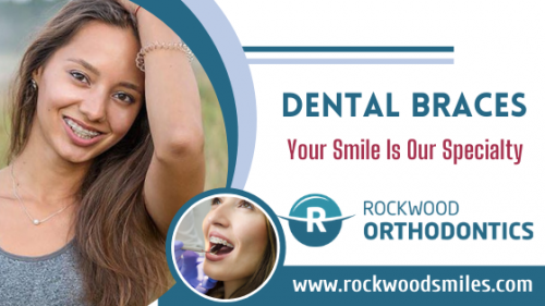 At Rockwood Orthodontics, we desire to make Braces and Invisalign treatment affordable. Sign up and save $1500 on comprehensive treatment!  Email us @info@rockwoodsmiles.com for more information.