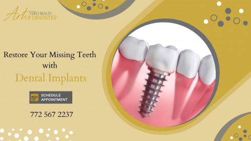 If you've lost a tooth due to injury or disease, contact Vero Beach Art of Dentistry. We offer dental implants to replace your missing tooth, protect the integrity of your remaining teeth and improve your oral health. Call (772) 567-2237 to schedule your visit!