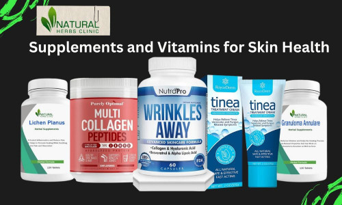Supplements-and-Vitamins-for-Skin-Health.jpg