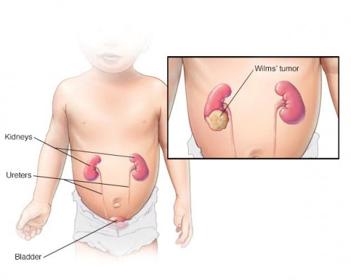 The kidney is an organ that cleanses the body and excretes waste in the urine. In addition to purifying blood, it also maintains electrolytes and fluids in the body... Read More:- https://bit.ly/2RXNnr6
