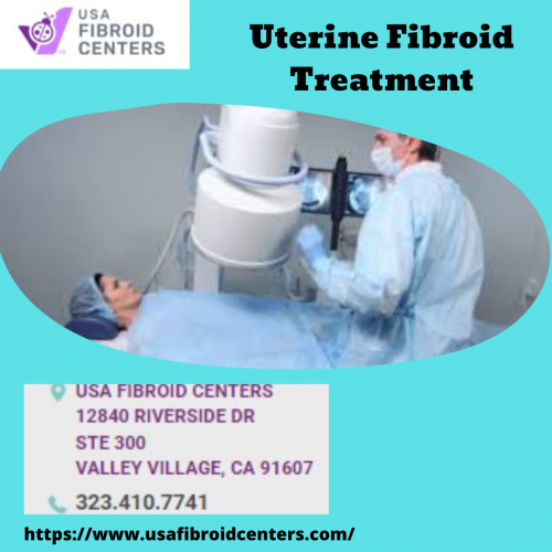 Uterine-Fibroid-treatment-4.png