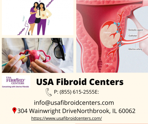 _USA-Fibroid-Centers___.png