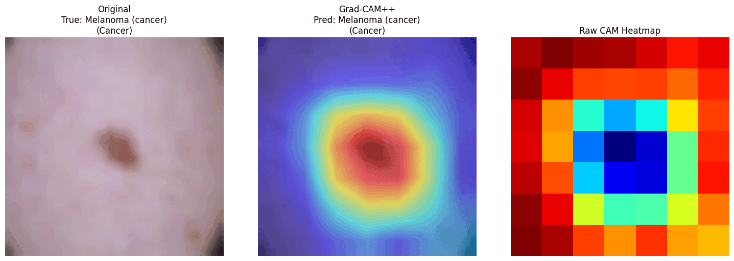 GradCAM++ results GIF