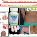 lichen-planus-treatment-by-natural-herbal-remedies