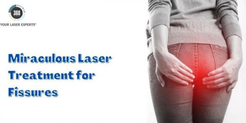 So, nowadays, patients feel fearless of surgeries. With bloodless and painless treatment for fissures by laser, patients have become relaxed.
https://laser360clinic.com/get-miraculous-treatment-for-fissures-and-stay-safe/